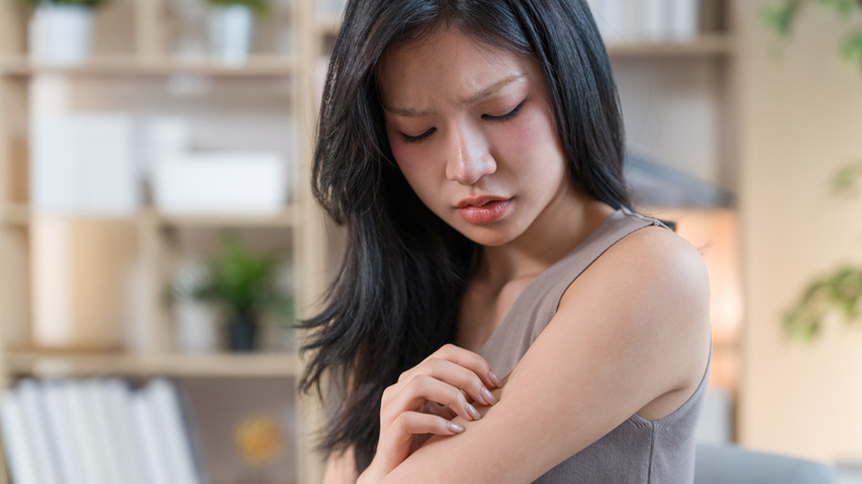 A woman touches an insect bite on her arm
